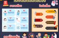 โรคหลอดเลือดสมอง